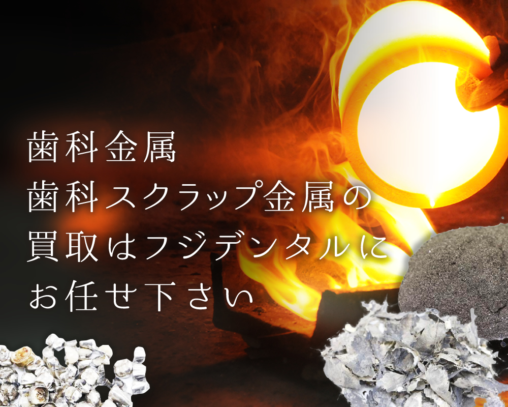 歯科スクラップ金属買取はフジデンタルにお任せ下さい