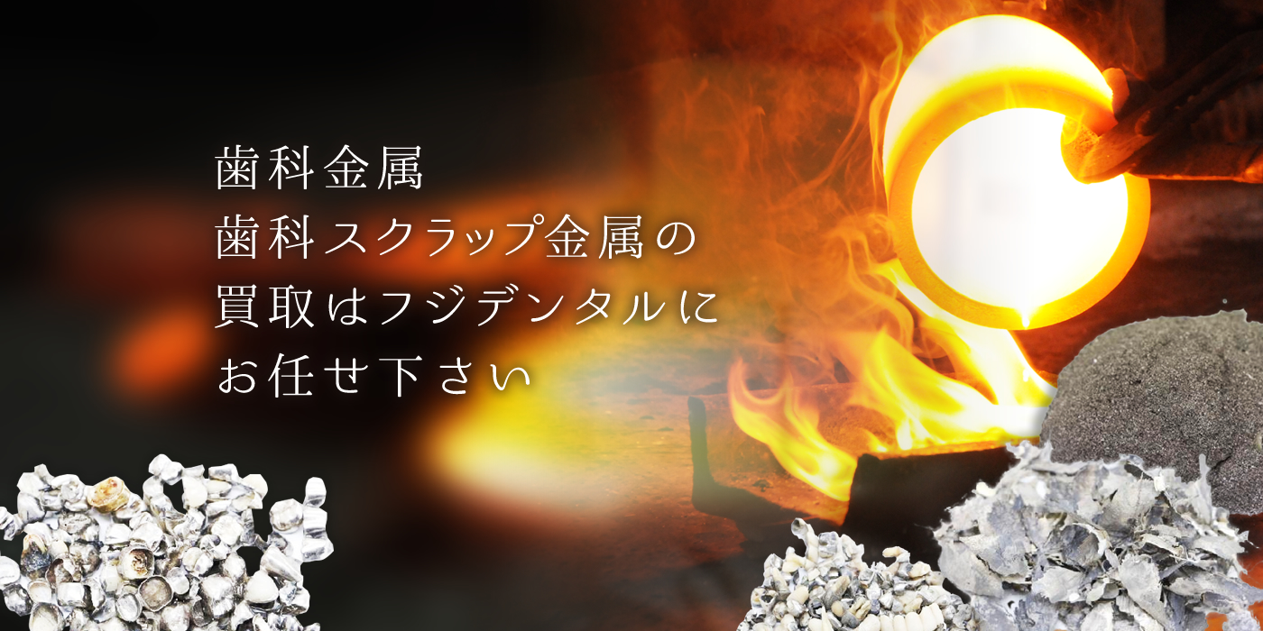 歯科スクラップ金属買取はフジデンタルにお任せ下さい